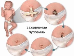 ���������� �������� �����